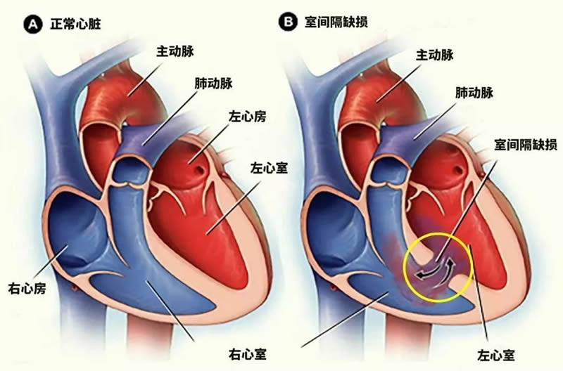 夏季保健需要养心,心脏的秘密 - 安美信精准医疗科普来了