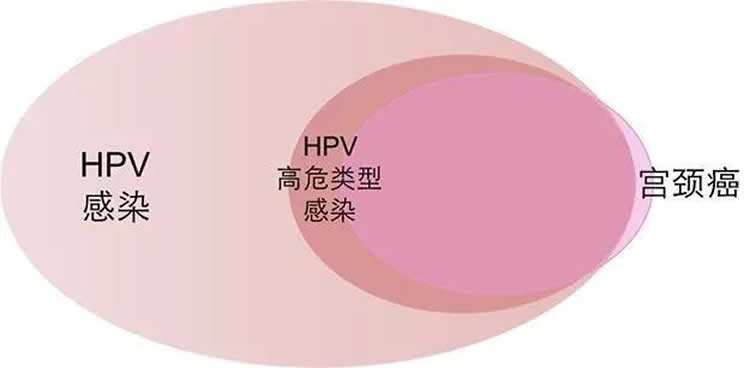 hpv疫苗与宫颈癌有什么关系安美信精准医疗科普尼尔惊喜社